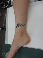 タトゥー（刺青）除去の術前