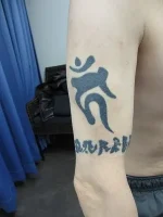 タトゥー（刺青）除去の術前